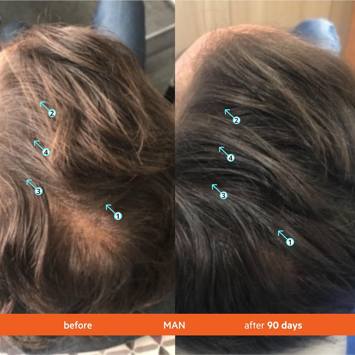 Revita Shampoo und Conditioner für dünner werdendes Haar, unterstützt das Wachstum, stärkt und verdi
