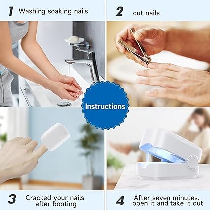 Gerät zur Behandlung von Nagelpilz, Nagelpilz, Fussnägel, Reinigung und Reparatur von Nägeln, Behand