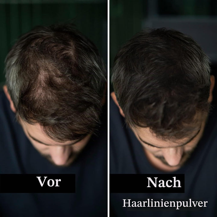 LEON MIGUEL Hair Fiber - Streuhaar - Premium Haarverdichtung/Schütthaar mit Soforteffekt bei Geheimr