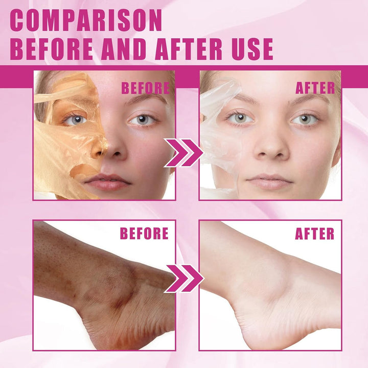 Extra Strong Gelbes Peeling Öl, 110ml Peeling-Öl Für Dunkle Haut Natural Spots Whitening Yellow Peel