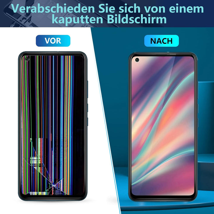 RongZy Display für Wiko View 5/View 5 Plus LCD Bildschirmersatz Digitizer Touchscreen Montiert Ersat