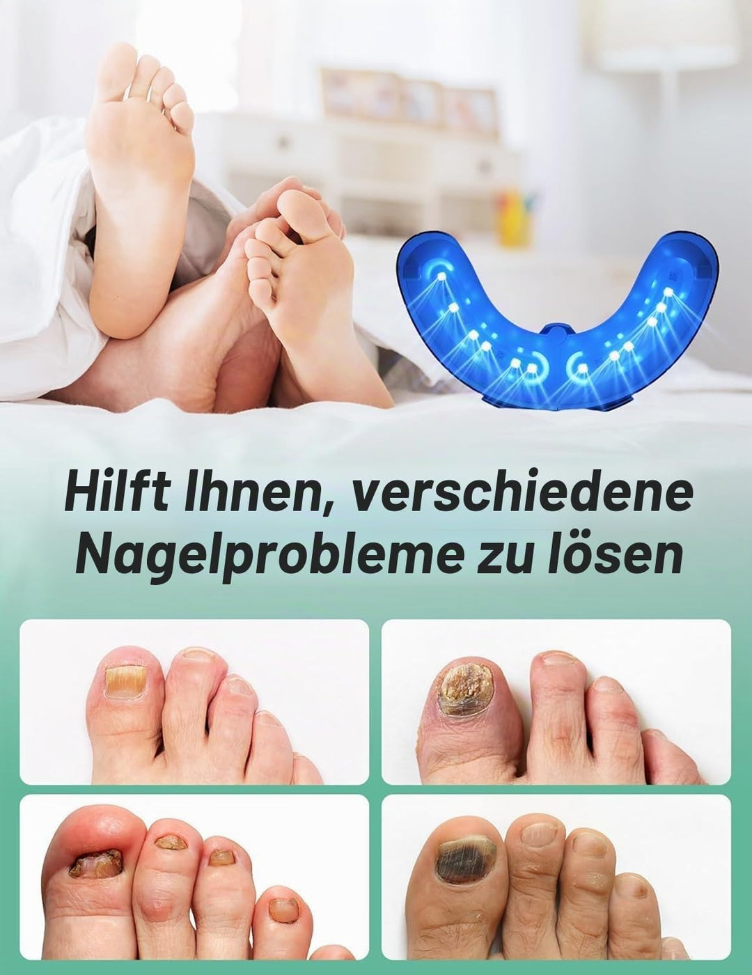 2025 Upgrade Nagelpilz Lasergerät, Nagelpilz Laser Gerät für Mehrere &amp; Fingernägel Lichttherapiegerä