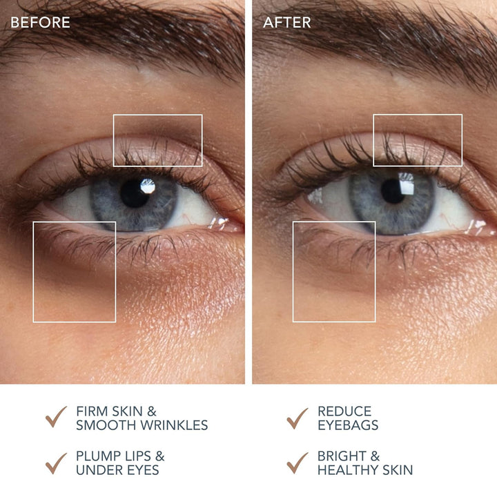 FOREO SUPERCHARGED Augen- und Lippenkontur Booster Serum - Leitfähige Augencreme - Niacinamid Serum