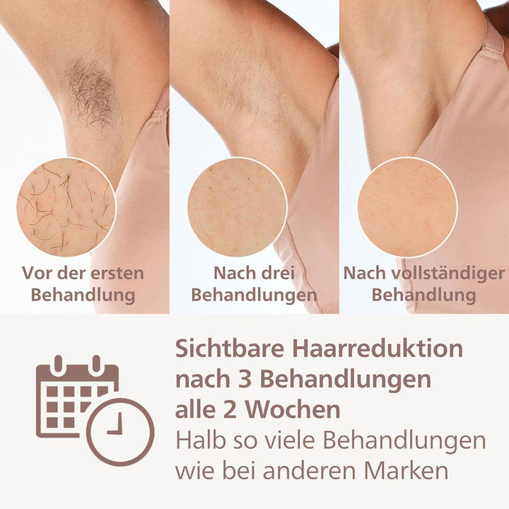 Philips Lumea IPL Prestige, 2 Aufsätze – Haarentfernungsgerät