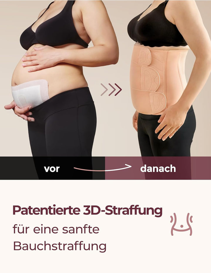 momcozy Ergowrap Bauchgurt nach Geburt, 3D-Kompression & Rückenstütze für Kaiserschnitt-Rückbildung,