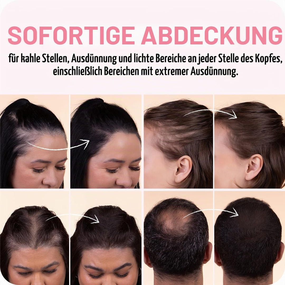 BOLDIFY Ansatzpuder 4g - Haar Concealer zur Haarverdichtung für Frauen und Männer, Grauabdeckung für