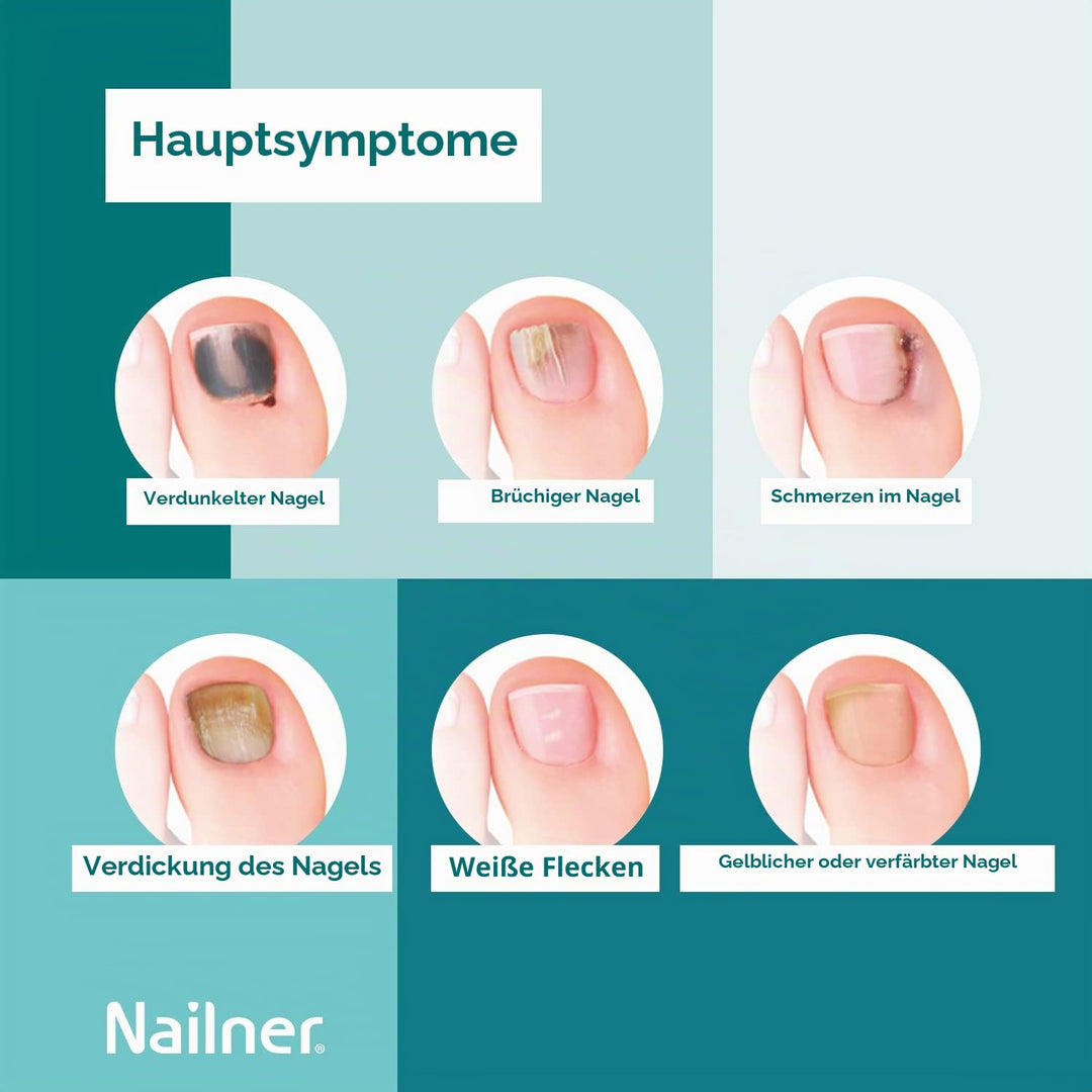 Nailner 2-in-1 Anti-Pilz-Pinsel für Nägel, 5 ml – Behandlung gegen Pilze an Händen und Füssen, sicht