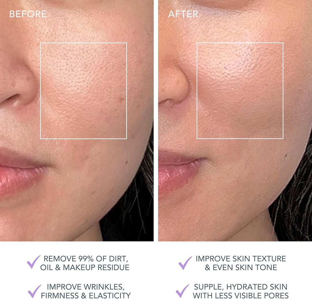 FOREO LUNA 4 plus Gesichtsbürste - Nahinfrarot-Lichttherapie + LED-Rotlichttherapie - Tiefenthermore