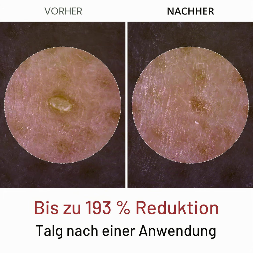 Dr.Melaxin Peel Shot Glow White Rice Peeling Ampulle Weiches Peeling Gesicht und Körper Peeling für