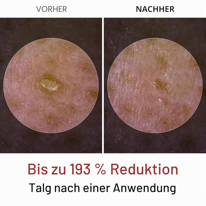 Dr.Melaxin Peel Shot Glow White Rice Peeling Ampulle Weiches Peeling Gesicht und Körper Peeling für