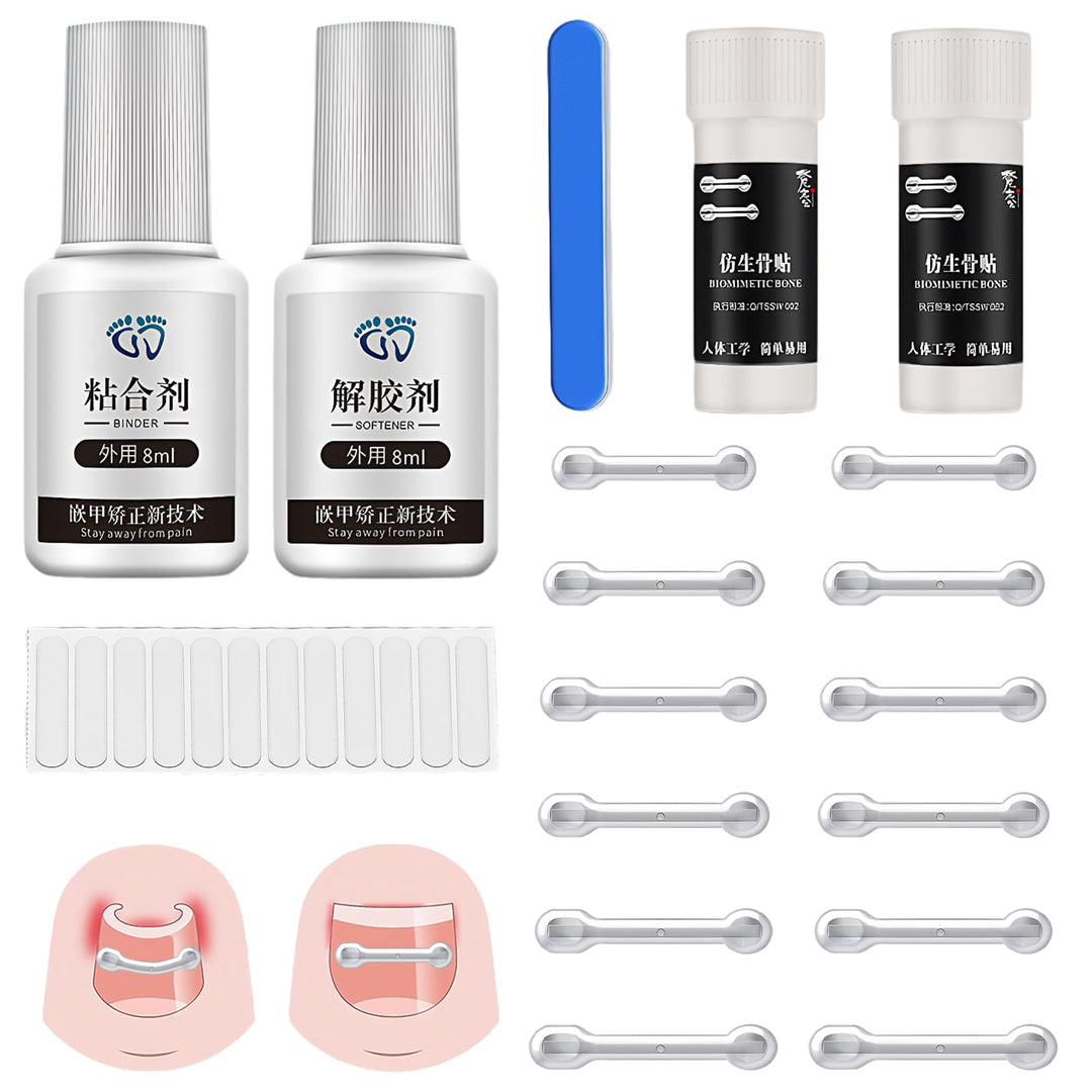 Eingewachsene Zehennägel Set, Zehennägel Korrektur Patch, Nagelspange Fussnägel Eingewachsener Zehna