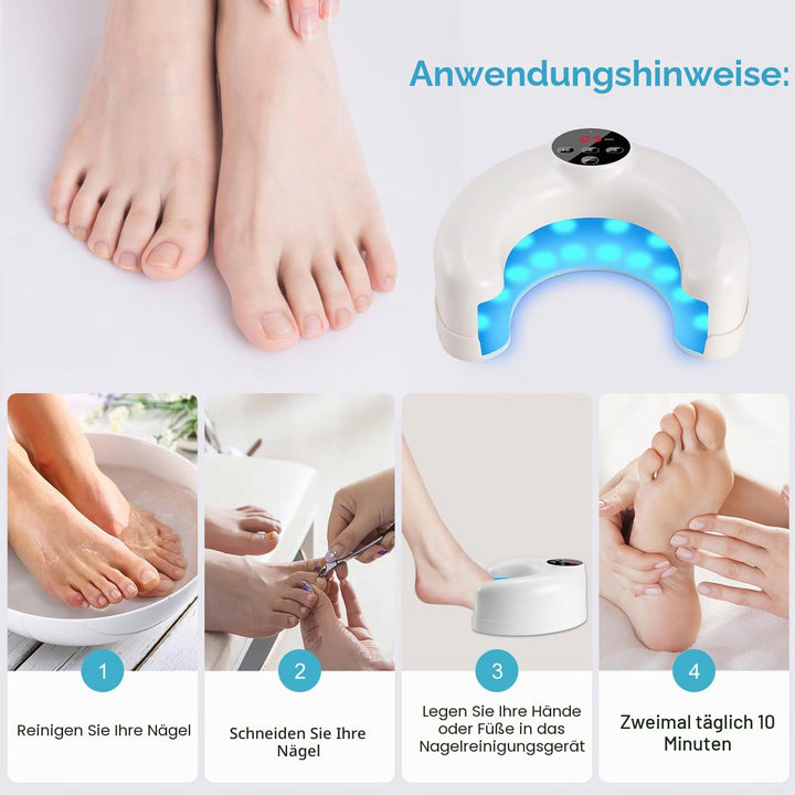 Lichtgerät zur Nagelpilz-Reinigung der 2. Generation für mehrere Zehen- und Fingernägel, Nagelrepara