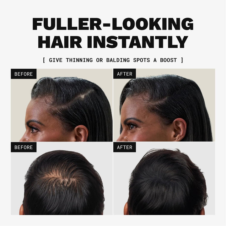 Toppik Haarfasern, Mittelbraun, natürlich gewonnene Fasern aus Keratin für voller aussehendes Haar 5