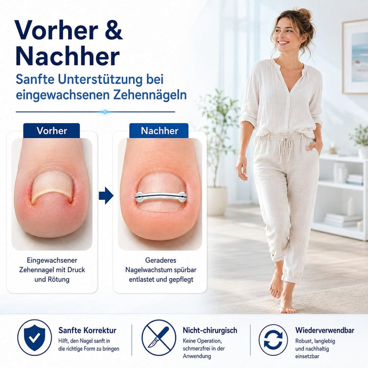 Eingewachsene ZehennäGel Set, Zehennagel Korrektur, 10 StüCk 5 GrössEn | Kleber &amp; Weichmacher, Sanft