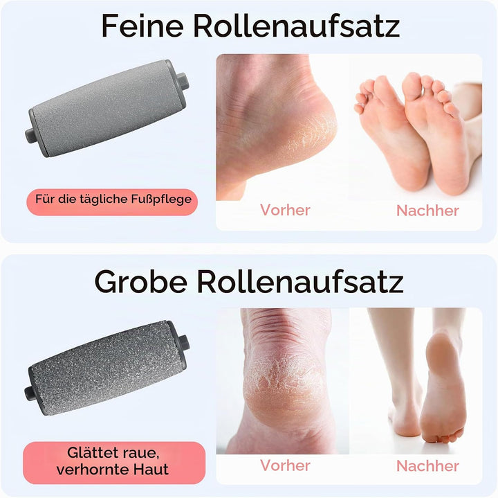 BarberBoss Elektrischer Hornhautentferner für Füsse, Tragbare Fussfeile, Wiederaufladbarer Hornhaute