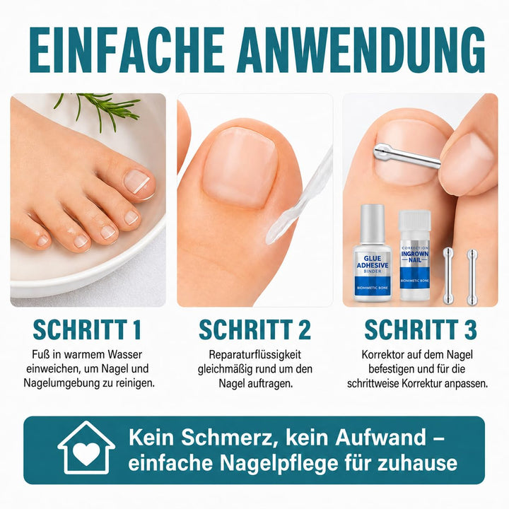 Eingewachsene Zehennägel Set, Zehennagel Korrektur,5 verschiedene Grössen 1 stück (1er Pack), 1 stüc