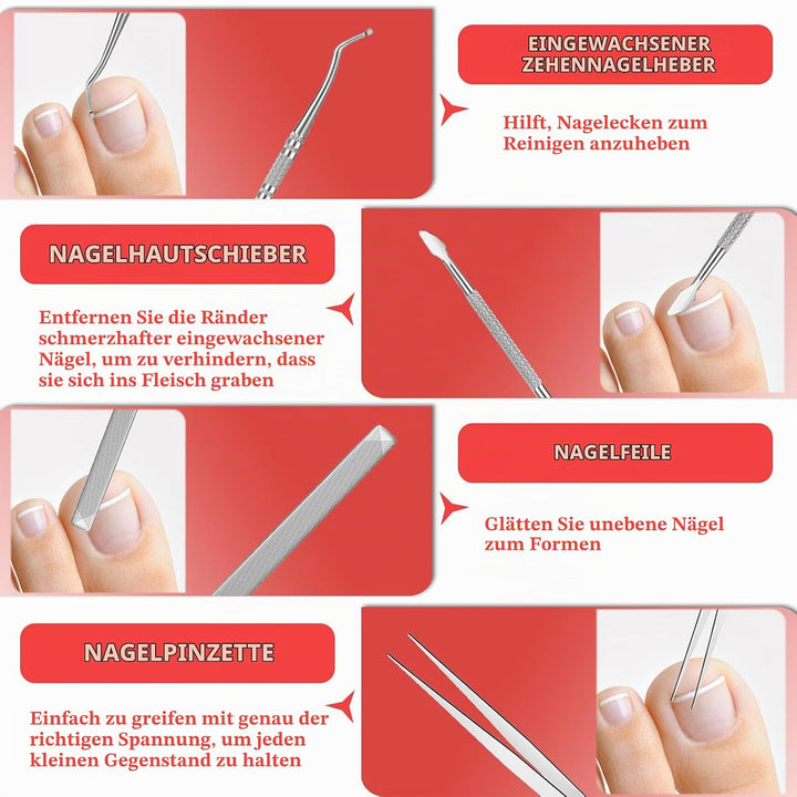 Ingrown Toenail Treatment, ELALRAU Ingrown Toenail Removal Kit with Ingrown Toenail Corrector Drops,