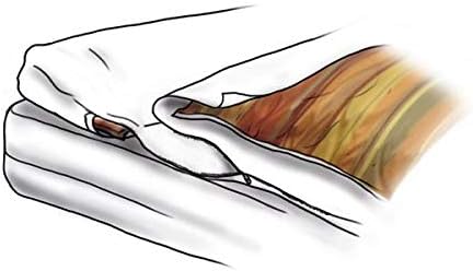 allsaneo Premium Allergiker Schlafsack 100x220 cm extra leicht und weich, ungefüttert, Hüttenschlafs