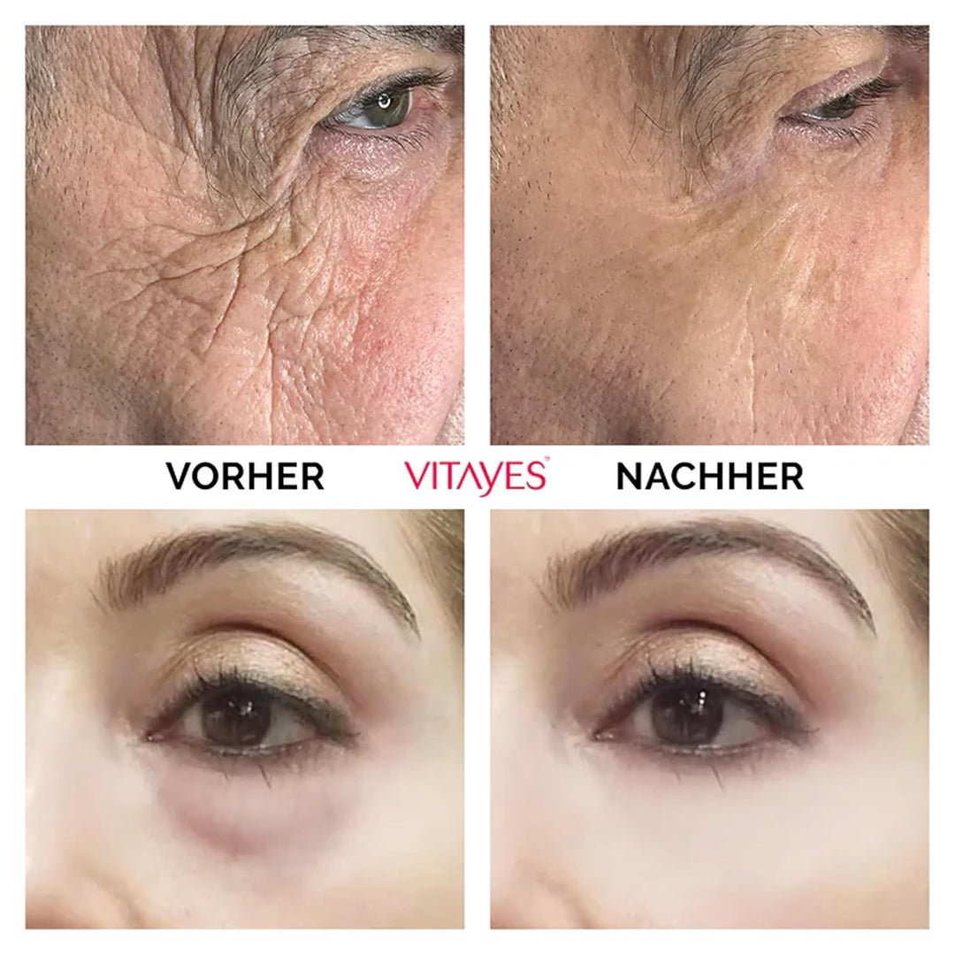 VITAYES Skincare Set Vegan - Instant Ageback 15 ml Mit Soforteffekt - Perfector Augenserum 15 ml - A