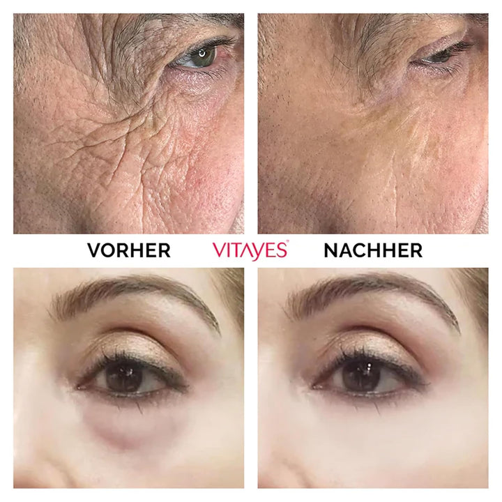 VITAYES Skincare Set Vegan - Instant Ageback 15 ml Mit Soforteffekt - Perfector Augenserum 15 ml - A
