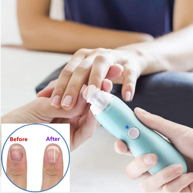 Baby Nagelfeile Elektrisch, Baby Nail Trimmer mit LED-Frontlicht, 9 Ersatz Schleifköpfen und Aufbewa