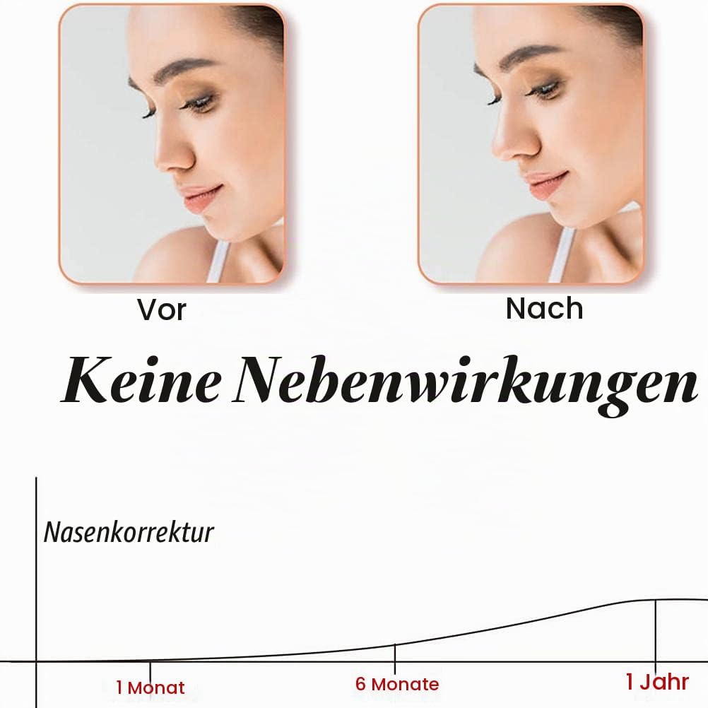 KKPLZZ Silikon-Nasenformer-Clip, schmerzfreies Nasenkorrekturgerät Nasensteg-Glätteisen-Korrektor Be
