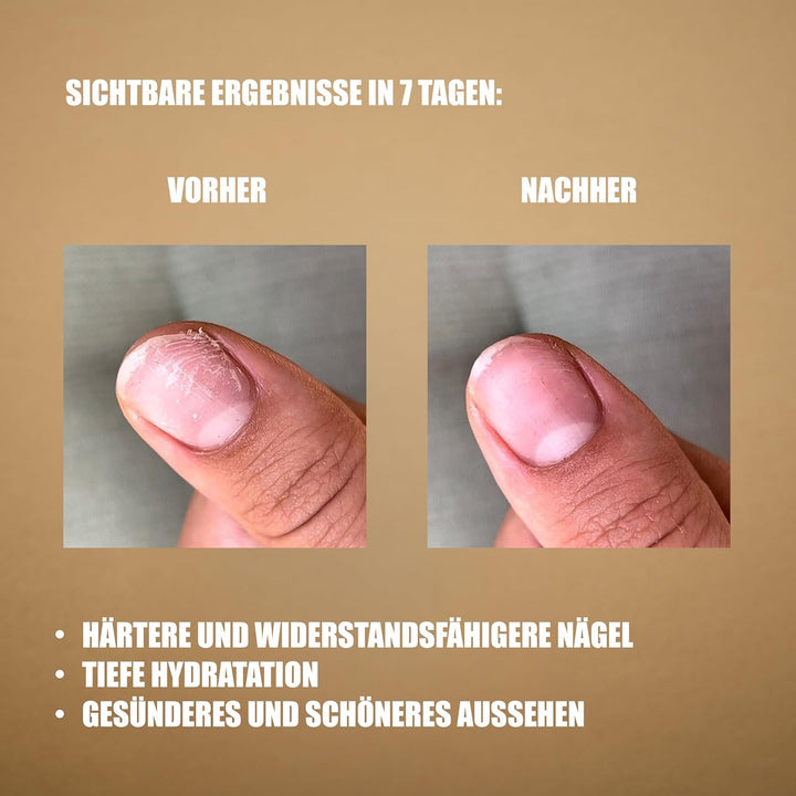 Lazonail®: Umfassende Pflege für Nägel und Nagelhaut | Nagelhärter in 30 Minuten | Erhöht Glanz und