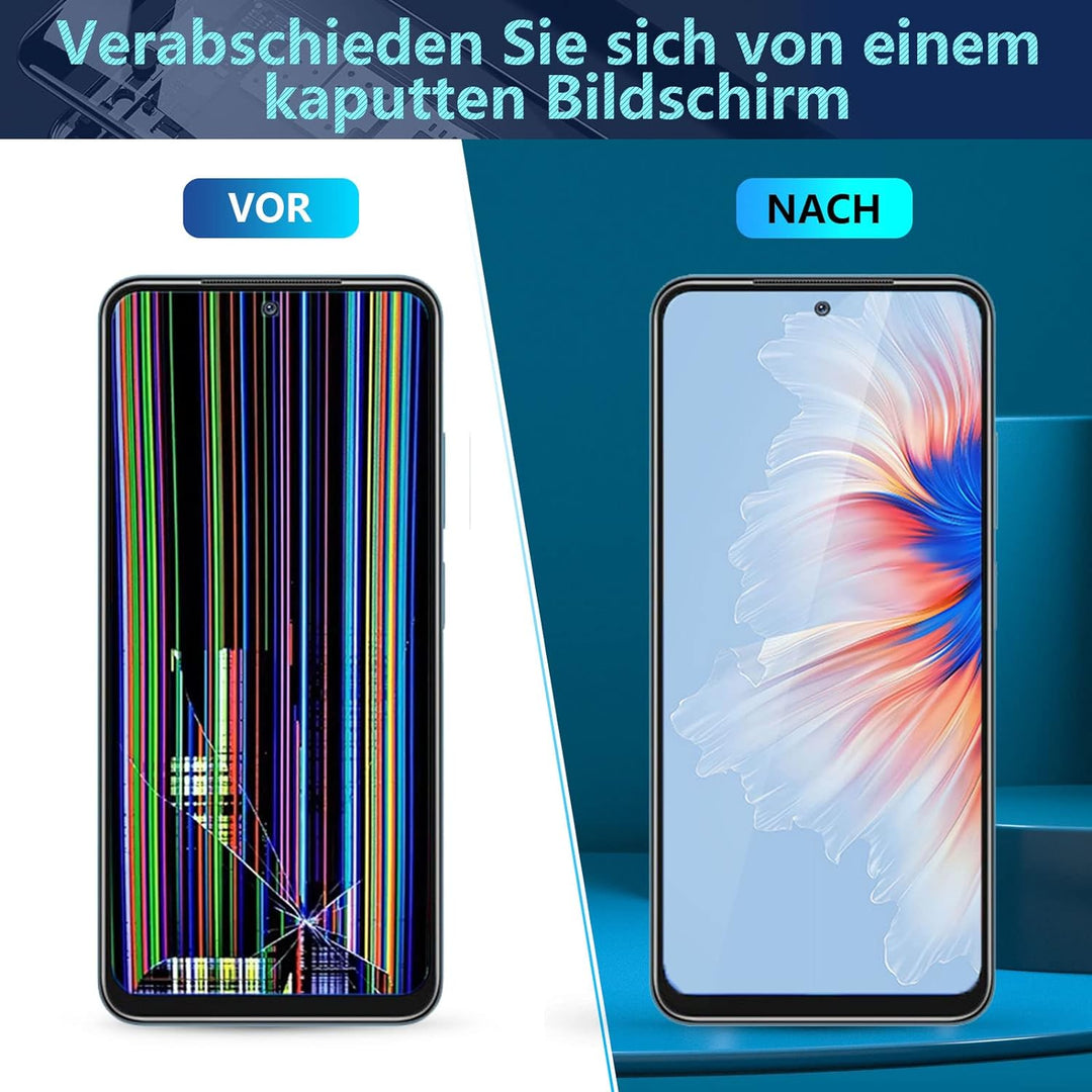 RongZy Ersatz Display Kompatibel für Xiaomi Redmi Note 11S /Redmi Note 11 2201117SG 2201117SI/220111