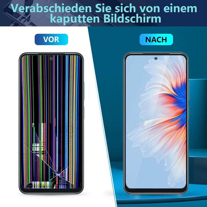 RongZy Ersatz Display Kompatibel für Xiaomi Redmi Note 11S /Redmi Note 11 2201117SG 2201117SI/220111