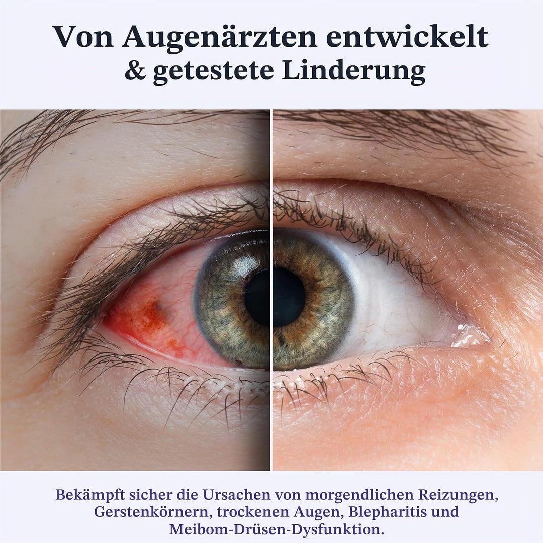 CorneaCare Ruhe: Selbsterwärmende warme Kompresse für trockene Augen, beheizte Augenmaske für schnel