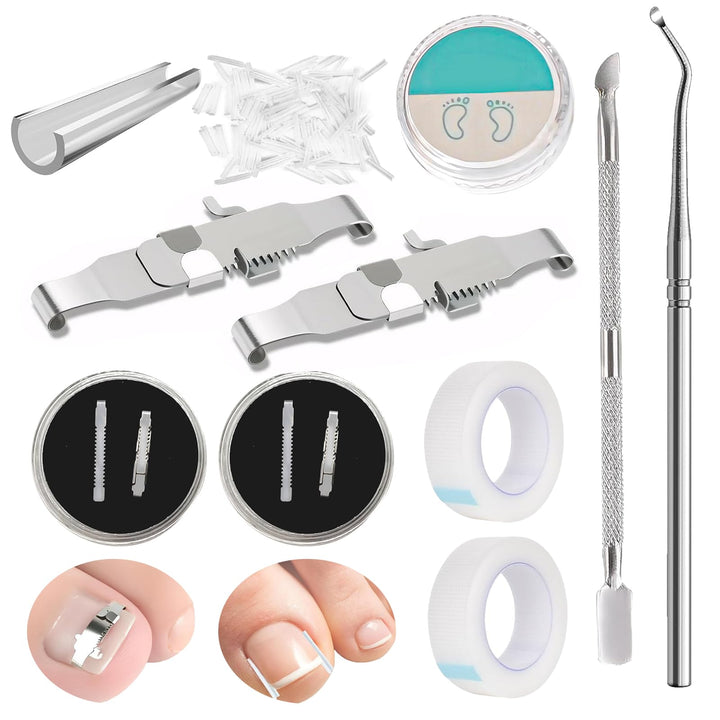 152 Pcs Nagelspange FussNäGel,Eingewachsene ZehennäGel Set,Zehennagel Eingewachsen,Nagelspange FussN
