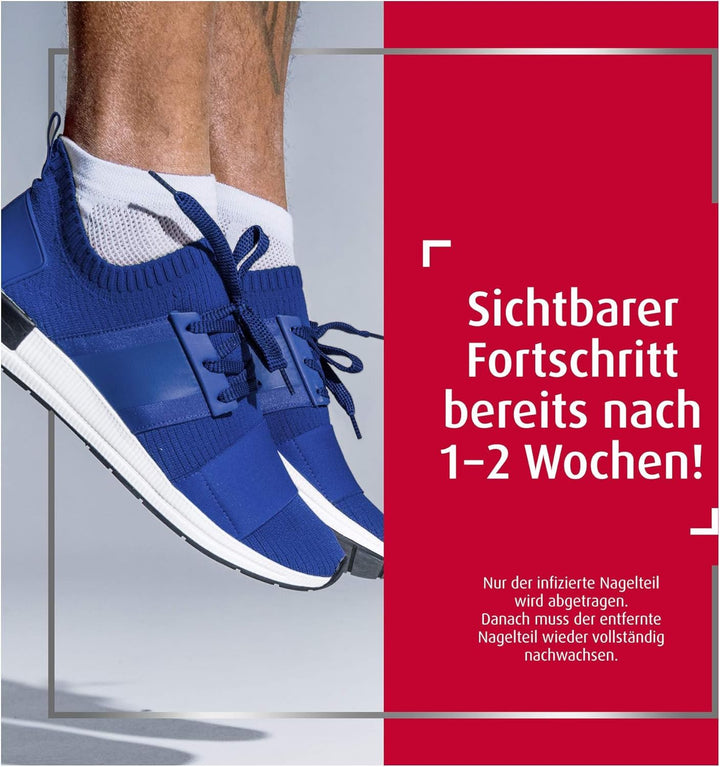 Sparset Canestan Extra Nagelset + Extra 20 g Creme - Vorteilspaket Kombiset
