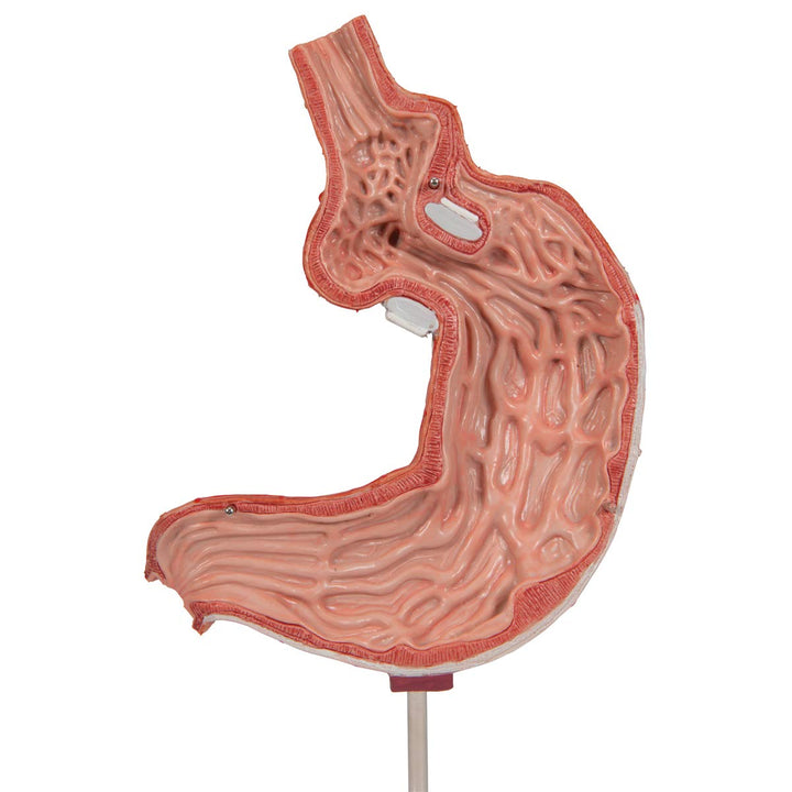 3B Scientific Menschliche Anatomie - Magenbandmodell + kostenlose Anatomie App - 3B Smart Anatomy