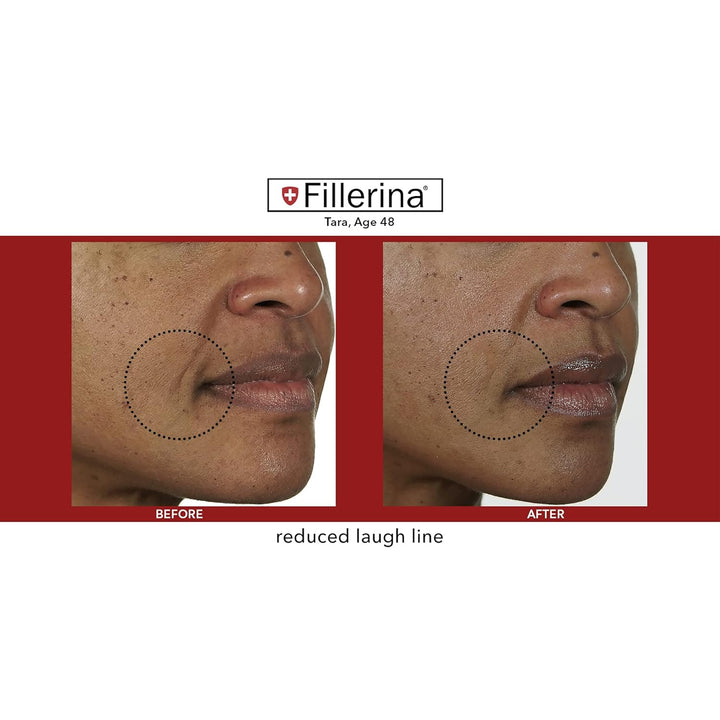 Fillerina Dermo Cosmetic Filler Treatment Grade 2