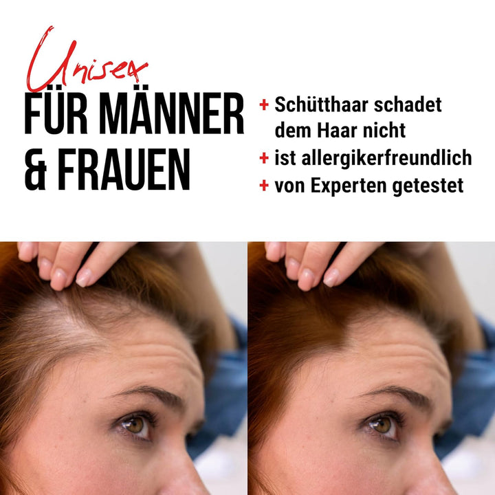 Hair Effect – Volles Haar in Sekunden! Premium Streuhaar 26g | Schütthaar zur Haarverdichtung und An
