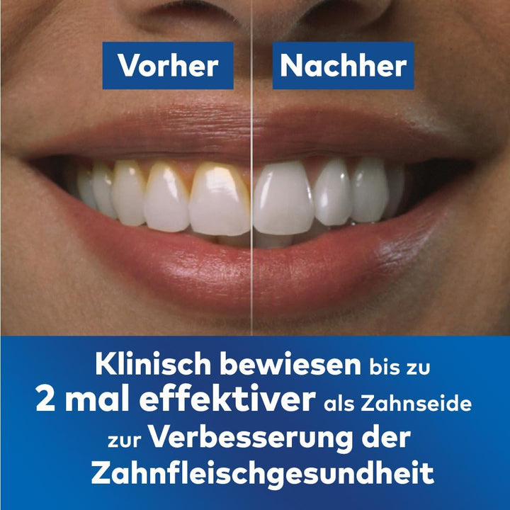 Waterpik Kabellose Munddusche, wiederaufladbar, elektrische Zahnreinigung, ideal zur Plaque-Entfernu