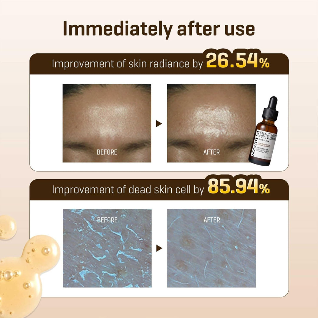 Some By Mi Galactomyces Pure Vitamin C Glow Serum, SBM0114, Transparent, 30 ml
