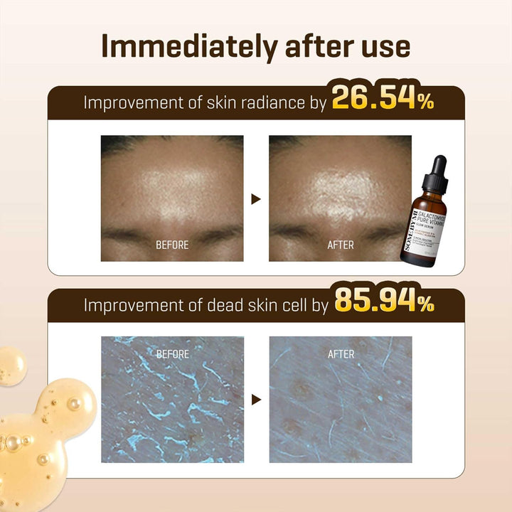 Some By Mi Galactomyces Pure Vitamin C Glow Serum, SBM0114, Transparent, 30 ml