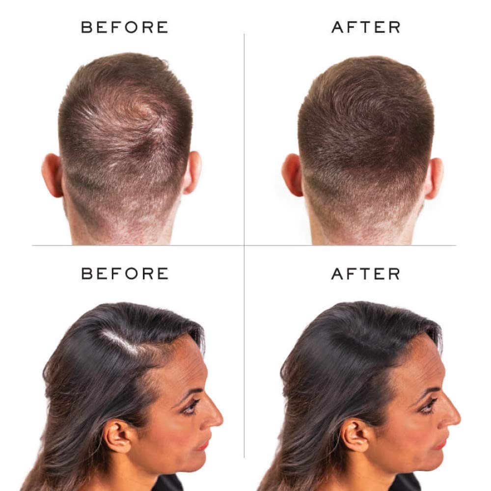 Nanogen Hair Thickening Fibres Dark Brown, 30g dunkelbraun 30g, dunkelbraun 30g