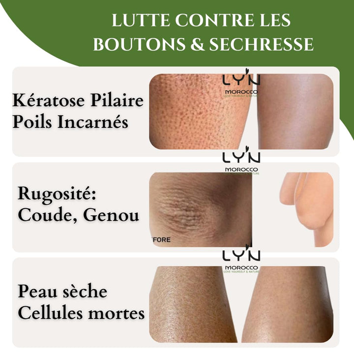 Ly'n Morocco TABRIMA SAHRAOUIA NILA und Weihrauch männlich Körpermaske Exfoliant für Knie, Ellbogen,