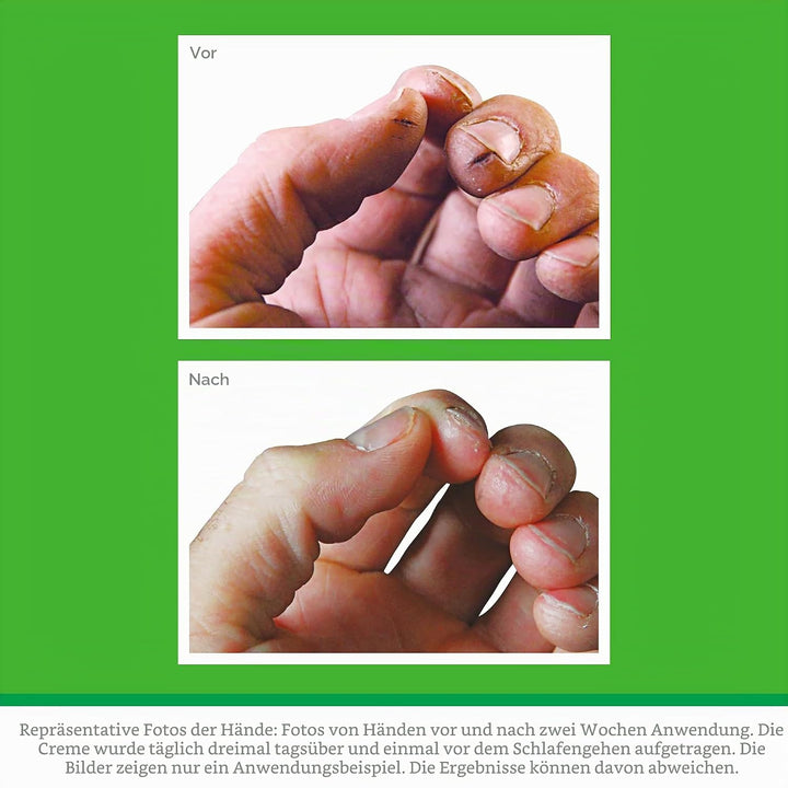 O'Keeffe's Working Hands 193 g (2 Stück) Glas: 193.00 g (2er Pack), Glas: 193.00 g (2er Pack)