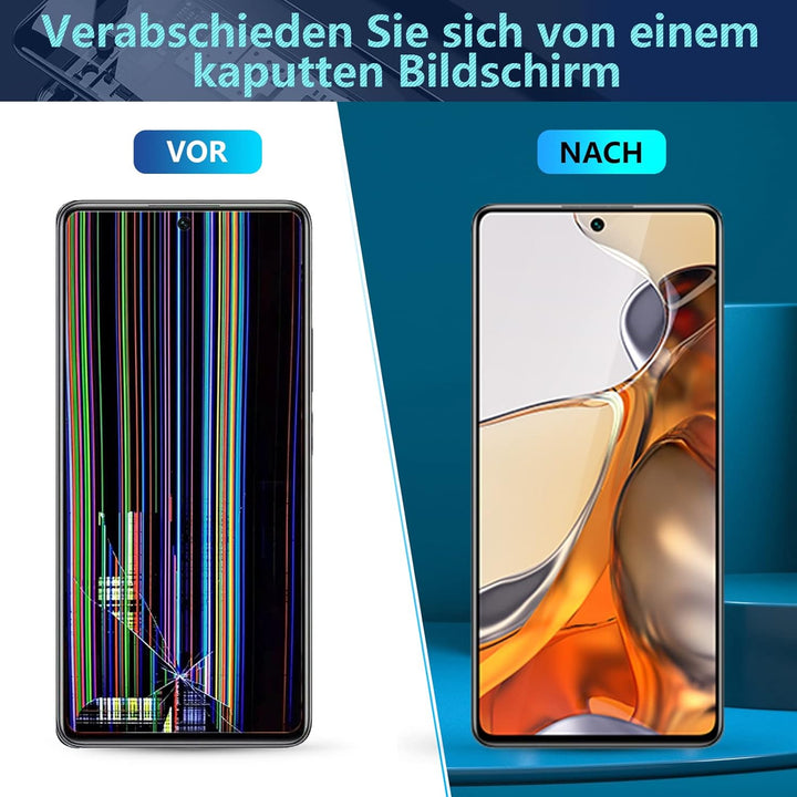 RongZy Kompatibel mit Xiaomi 11T Pro 2107113SG Ersatz Bildschirm LCD Display und Touchscreen-Digitiz
