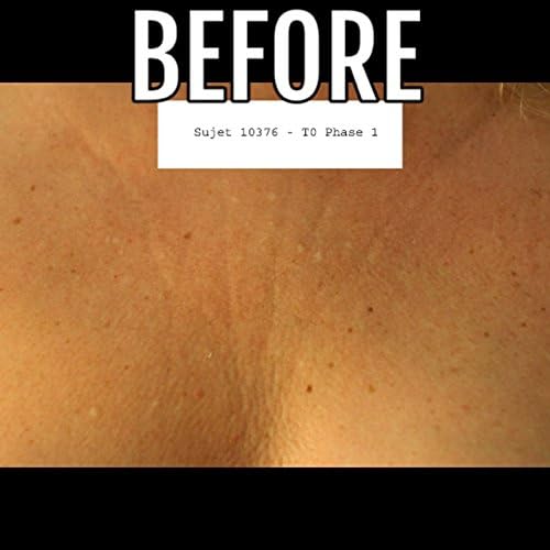 La Decollette Original faltenfreie Dekolettee Schlaf BH Uni Grösse