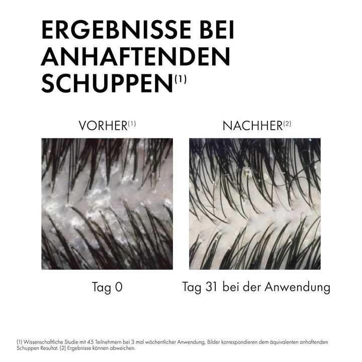 Vichy Dercos Anti-Schuppen Behandlung Shampoo für normales bis fettiges Haar, Nachfüllpackung, 500 m