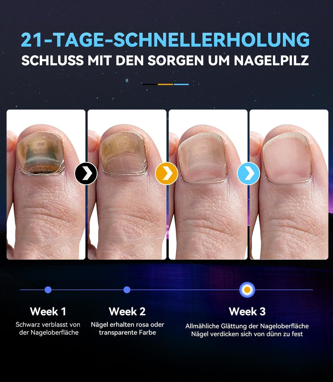 Neues 3.0 Upgrade Nagelpil Laser Gerät【7 Tage Schnell Wirkende】【mit Zeitanzeige - Nagelpil Lasergerä