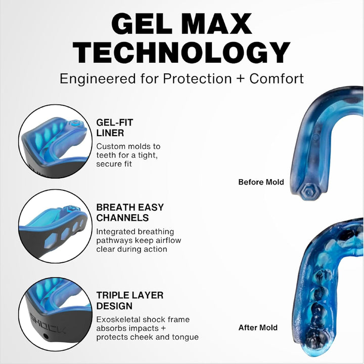 Shock Doctor ShockDoctor Mundschutz Gel Max Einheitsgrösse Carbon, Einheitsgrösse Carbon