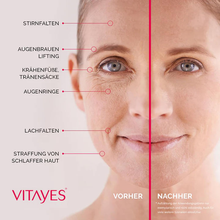 VITAYES Skincare Set Vegan - Instant Ageback 15 ml Mit Soforteffekt - Perfector Augenserum 15 ml - A