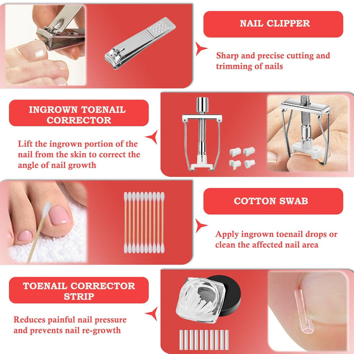 Ingrown Toenail Treatment, ELALRAU Ingrown Toenail Removal Kit with Ingrown Toenail Corrector Drops,