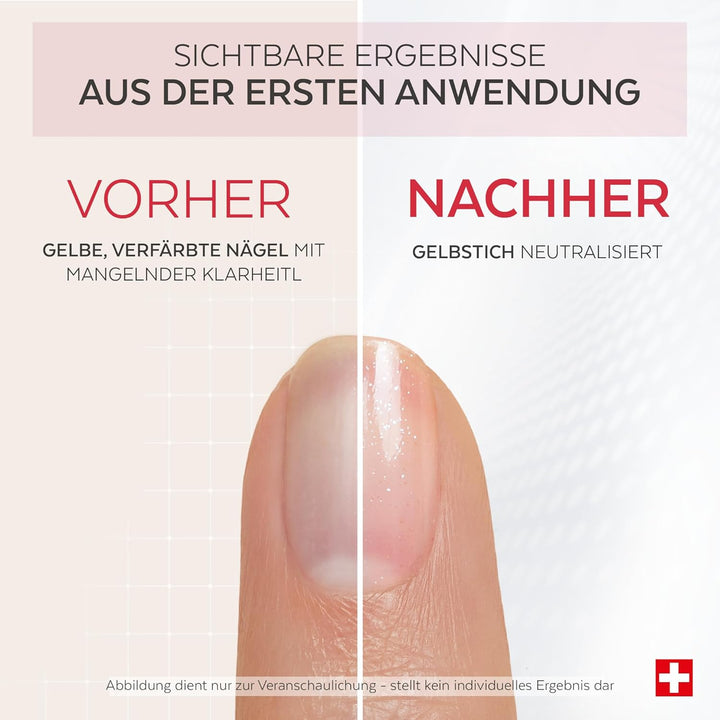 PODERM Korrigierender & Perfektionierender Pflege-Nagellack – Glanz-Booster | 8 ML – Belebt natürlic
