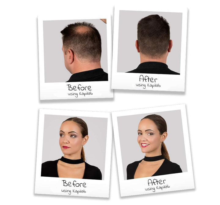 Kapilab Streuhaar Blond, Premium Haarpuder zur Haarverdichtung Haarfasern für Dünner Werdenes Haar K